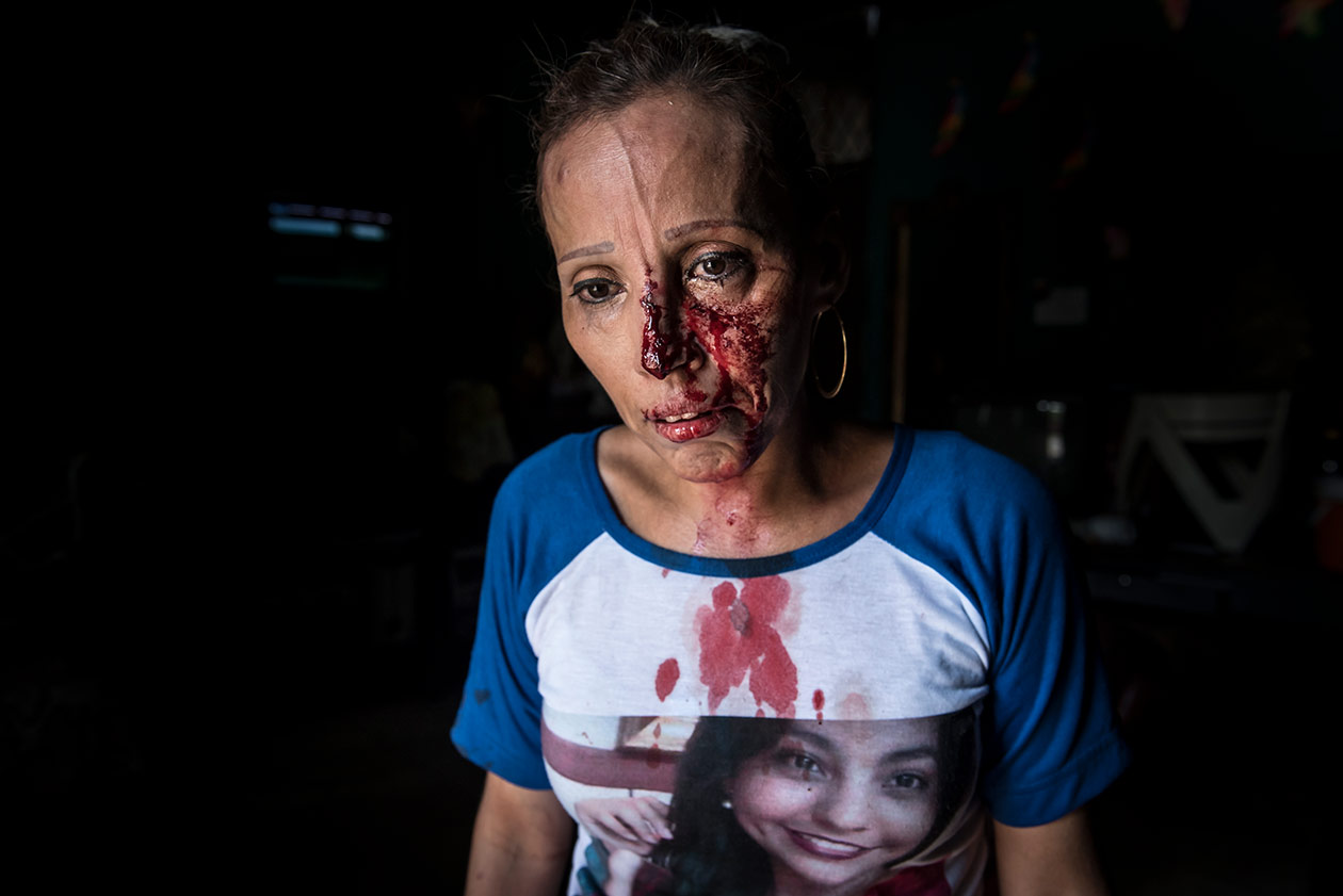 Como resultado del ataque perpetrado por los antimotines y turbas, decenas de personas fueron heridas, incluido el periodista Wiston Potosme del programa Café con Voz. Además que se realizaron al menos diez detenciones según informó el Centro Nicaragüense de Derechos Humanos (Cenidh). Foto: Óscar Navarrete | Niú